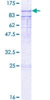 Human ESRP1 / RBM35A Protein (Recombinant GST)