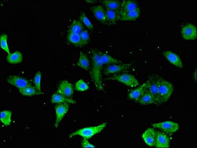 CD247 / CD3 Zeta Antibody