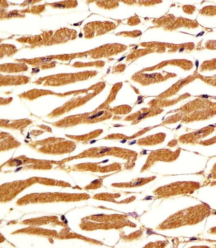 Polyclonal Rabbit anti-Human PGM1 / Phosphoglucomutase 1 Antibody (aa469-501, IHC, WB)