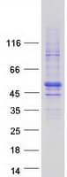 Human ZNHIT2 Protein (Recombinant Myc-DDK (Flag))