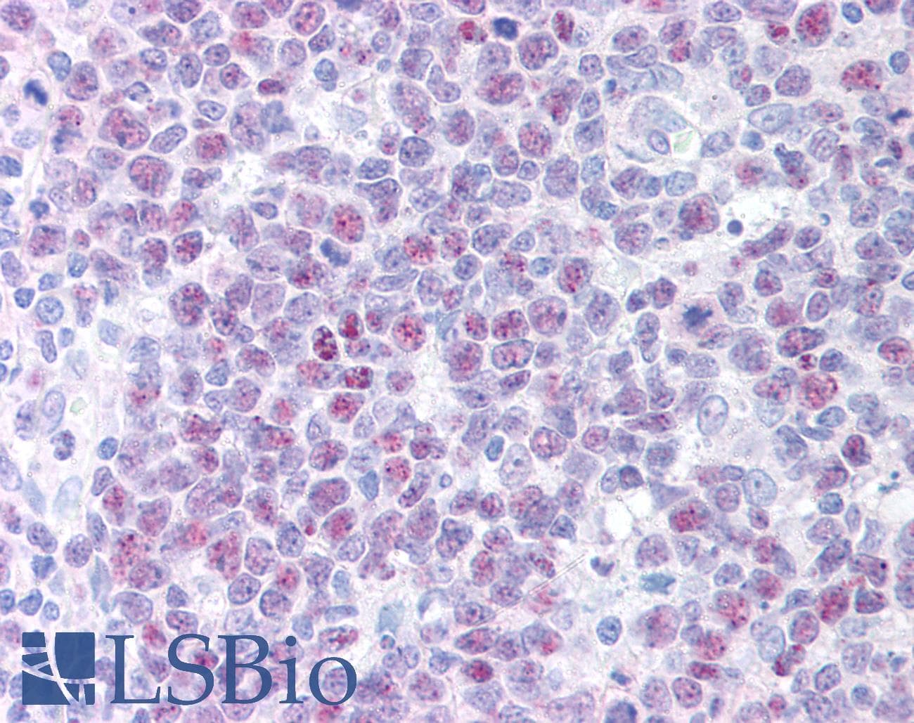 IHC-plus™ Monoclonal Mouse anti-Human POLD1 Antibody (clone 607, aa1-140, IHC, WB)