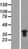 ZWINT Protein (Over-Expression Lysate Myc-DDK (Flag))