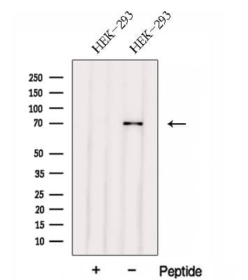 Polyclonal Rabbit anti-Human FERMT1 / Kindlin Antibody (WB)