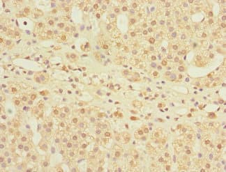 Mannose Phosphate Isomerase Antibody