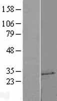 UCK2 Protein (Over-Expression Lysate Myc-DDK (Flag))