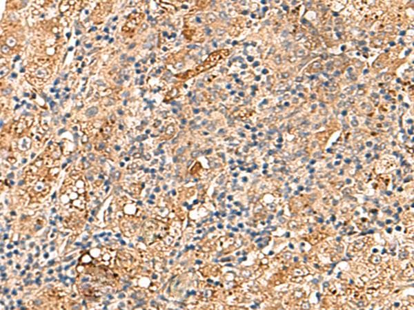 Polyclonal Rabbit anti-Human DNAJC14 Antibody (IHC, WB)