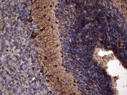 NCAM / CD56 Antibody (aa20-718, clone OTI3H2)