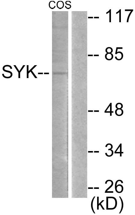 SYK Antibody (aa491-540)