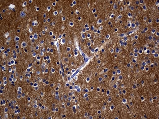 Monoclonal Mouse anti-Human RGS17 / RGSZ2 Antibody (clone OTI8G4, Carrier-free, IHC, WB)