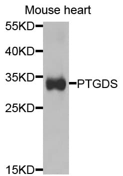 Polyclonal Rabbit anti-Human Prostaglandin D Synthase Antibody (IHC, WB)