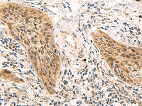 PSME1 Antibody