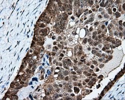 PSMC3 Antibody (clone OTI6E10)