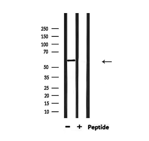 YTHDF1 Antibody