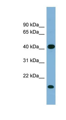 Polyclonal Rabbit anti-Human BRIX1 Antibody (aa179-228, WB)