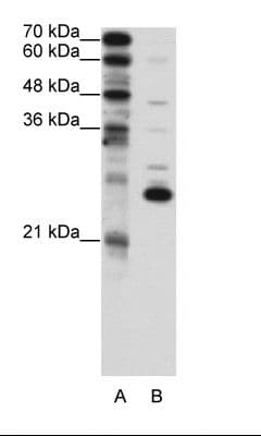 Polyclonal Rabbit anti-Human Recoverin Antibody (aa131-180, IHC, WB)