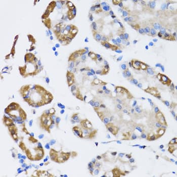 NAA10 / ARD1A Antibody