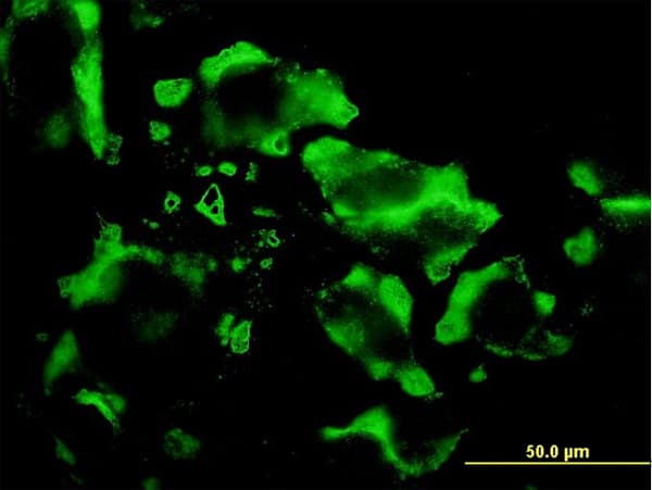 EIF4E2 / IF4e Antibody (clone 4G10)