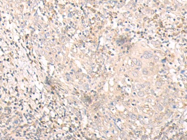 IL24 Antibody