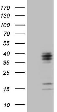 Monoclonal Mouse anti-Human C21orf62 Antibody (clone OTI1B8, WB)