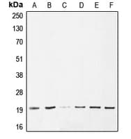 Polyclonal Rabbit anti-Human BAX Antibody (Internal, IHC, IF, WB)
