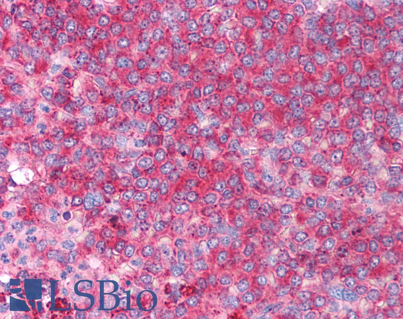 IHC-plus™ Polyclonal Rabbit anti-Human CD82 Antibody (IHC, IF, WB)