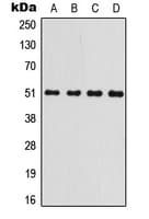 GSK3A / GSK3 Alpha Antibody (N-Terminus)