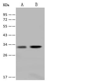 Polyclonal Rabbit anti-Human FN3KL / FN3KRP Antibody (IHC, WB)