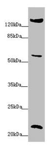 PPIF / Cyclophilin F Antibody