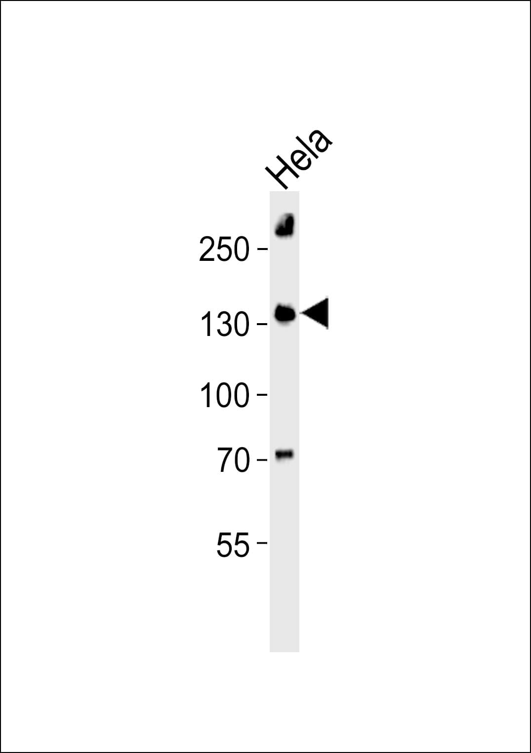 Polyclonal Rabbit anti-Human DHX8 Antibody (aa339-373, WB)