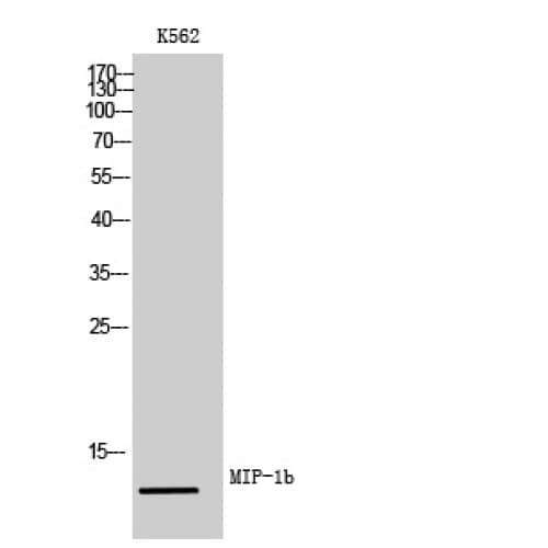 Polyclonal Rabbit anti-Human CCL4 / MIP-1 Beta Antibody (31-80 aa, Internal, WB)