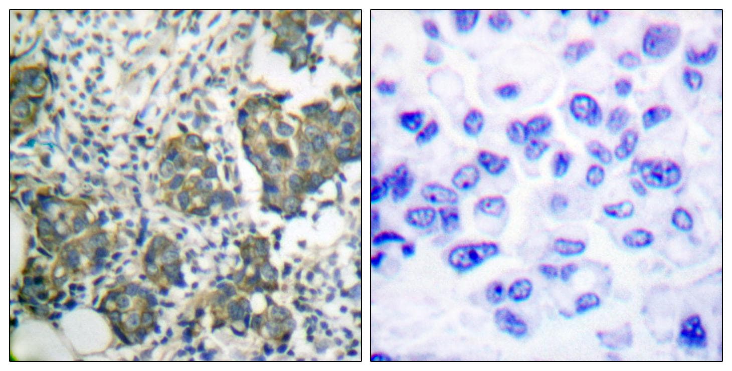Polyclonal Rabbit anti-Human KRT8 / CK8 / Cytokeratin 8 Antibody (p73, IHC, IF, WB)