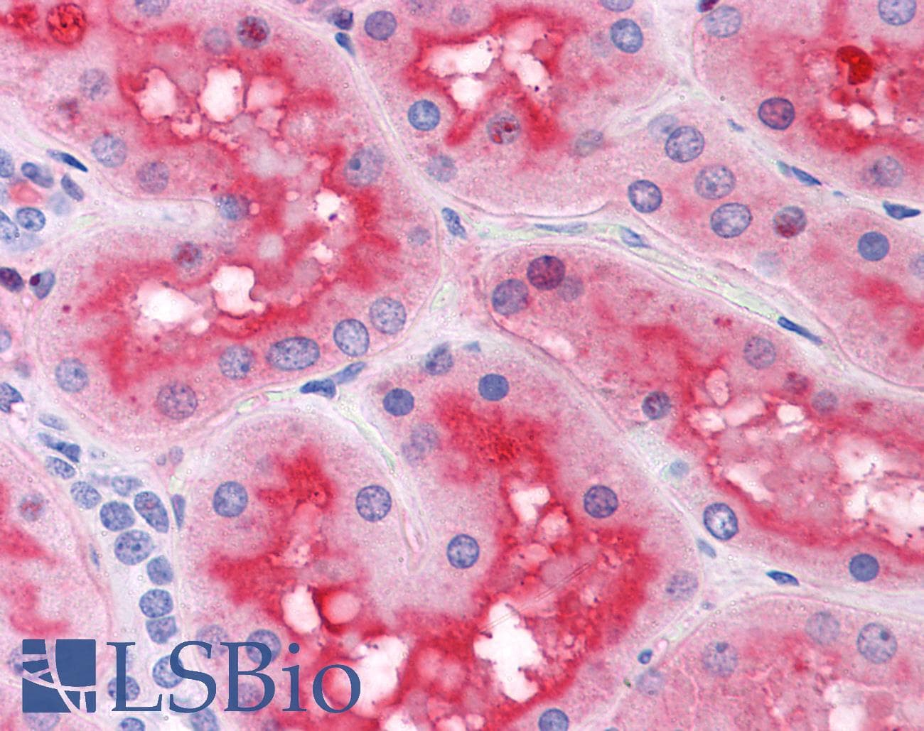 IHC-plus™ Monoclonal Mouse anti-Human ACOT9 Antibody (clone 4E4, IHC, IF, WB)