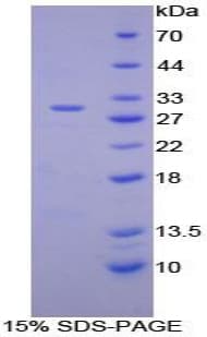 Mouse ITGAD / CD11d Protein (Recombinant His-T7)