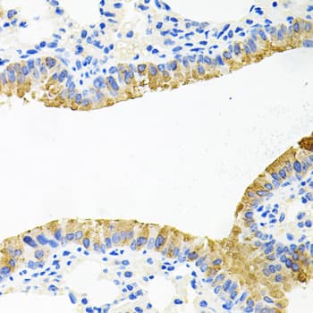 Polyclonal Rabbit anti-Human TOB2 Antibody (IHC, WB)