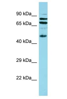 Polyclonal Rabbit anti-Human GPSM2 / LGN Antibody (aa105-154, WB)