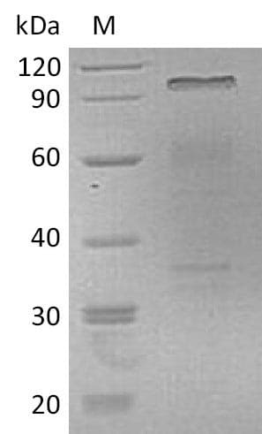 Human HGF / Hepatocyte Growth Factor Protein (Recombinant 6His, C-terminus)