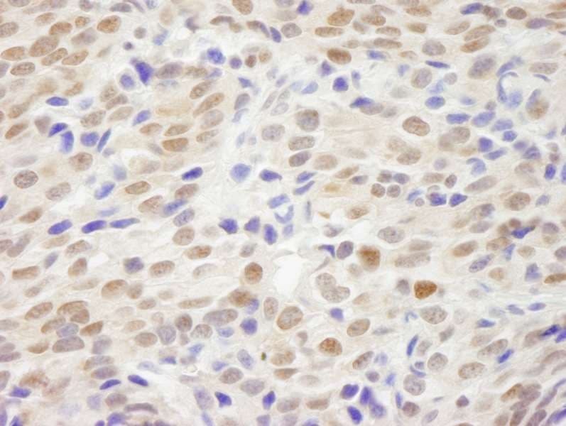 Polyclonal Rabbit anti-Human NHEJ1 / XLF Antibody (aa250-C-term, IHC, WB)