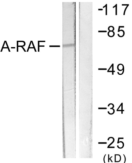 IHC-plus™ Polyclonal Rabbit anti-Human ARAF / ARAF1 / A-RAF Antibody (aa276-325, IHC, WB)