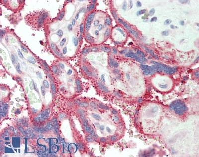 IHC-plus™ Polyclonal Rabbit anti-Human EPOR / EPO Receptor Antibody (aa31-79, IHC)