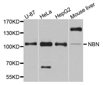 NBN / Nibrin Antibody