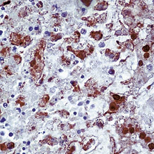 Polyclonal Rabbit anti-Herpes Simplex Virus HSV-1 / Herpes Simplex Virus 1 Antibody (IHC)