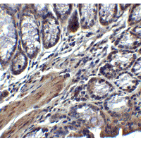 IL17A Antibody