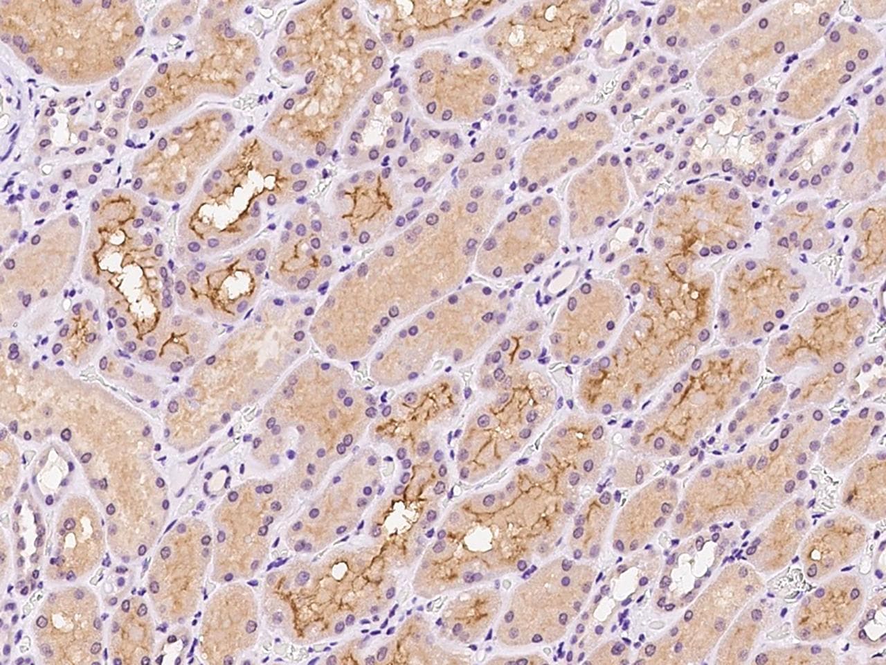 ENPP3 / CD203c Antibody