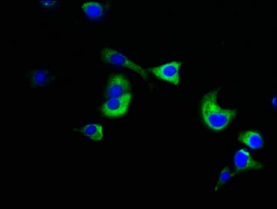 NUMA1 / NUMA Antibody
