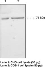 IHC-plus™ Polyclonal Rabbit anti-Hamster PLA2G6 / IPLA2 Antibody (aa557-576, IHC, WB)