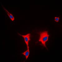 Polyclonal Rabbit anti-Human HSP90AA1 / Hsp90 Alpha A1 Antibody (C-Terminus, IHC, IF, WB)