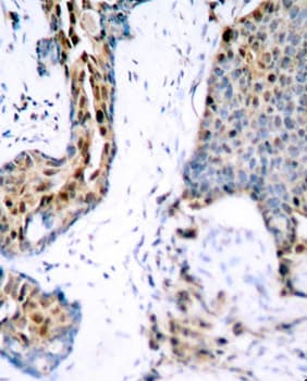 ER Alpha / Estrogen Receptor Antibody (phospho-Ser118)