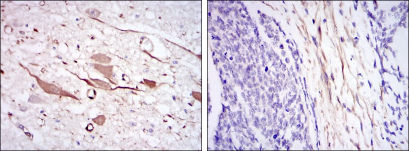 HSPB2 / HSP27 Antibody (clone 5D7)
