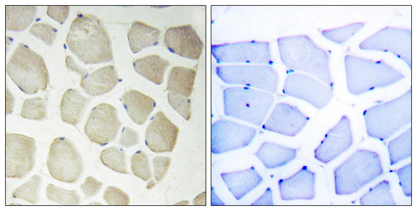 Polyclonal Rabbit anti-Human CDKL3 Antibody (IHC)