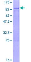 Human PNKP Protein (Recombinant GST)